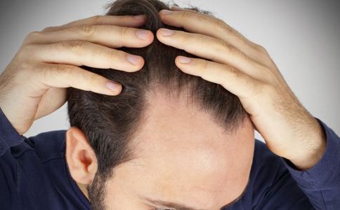 為什么男性比女性更容易脫發？